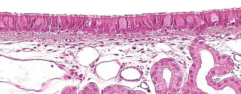 Рисунок 1: Реснитчатый&nbsp;псевдослойный&nbsp;эпителий&nbsp;с бокаловидными клетками, характеристика дыхательной системы
